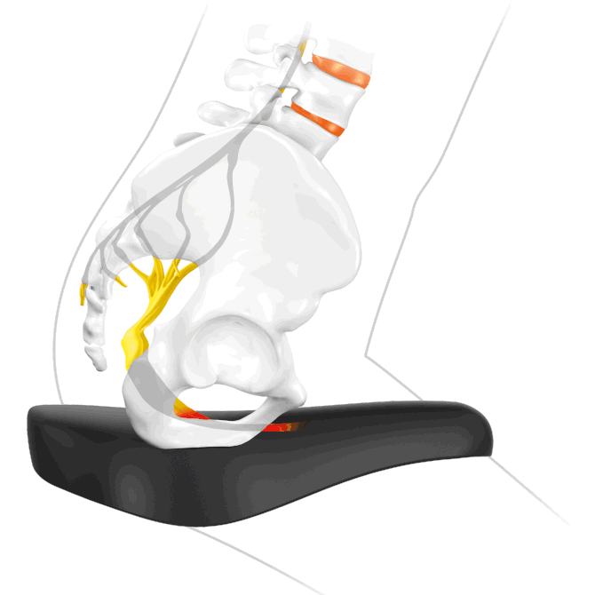 filters_grayscalefalse_blur0_quality80-1